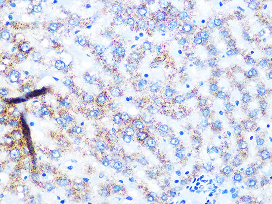 NDUFS3 Rabbit mAb