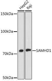 SAMHD1 Rabbit mAb