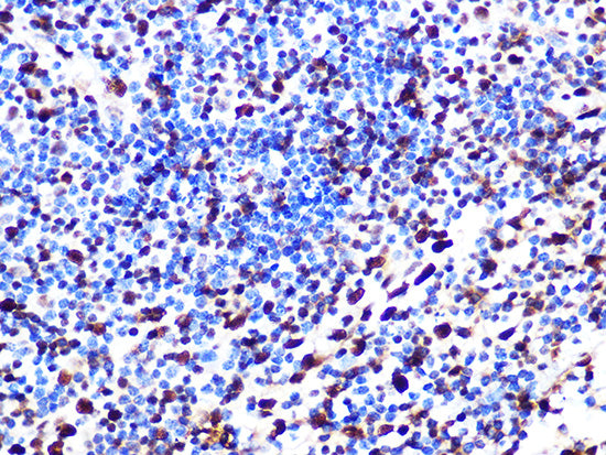 SAMHD1 Rabbit mAb