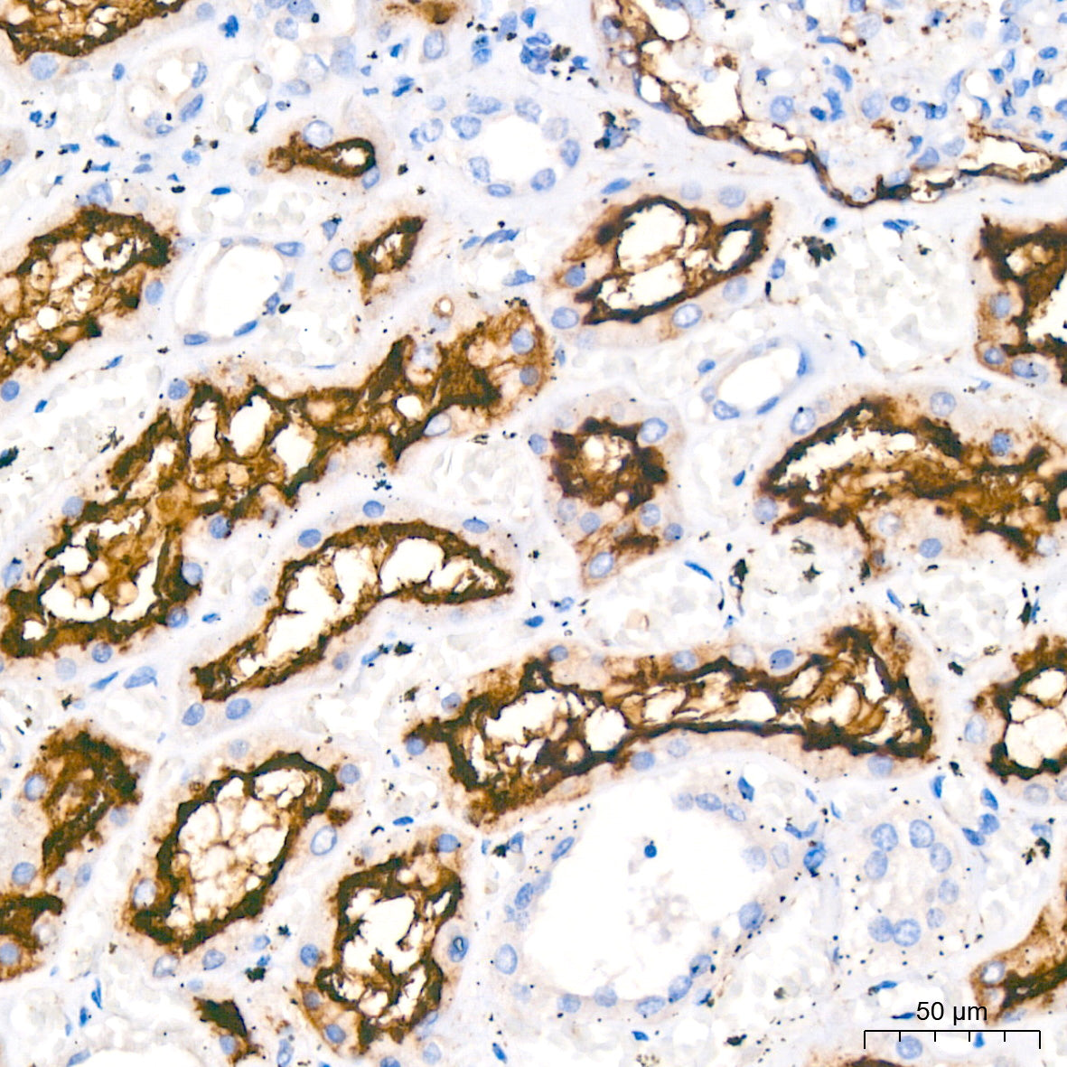 ACE2 Rabbit mAb