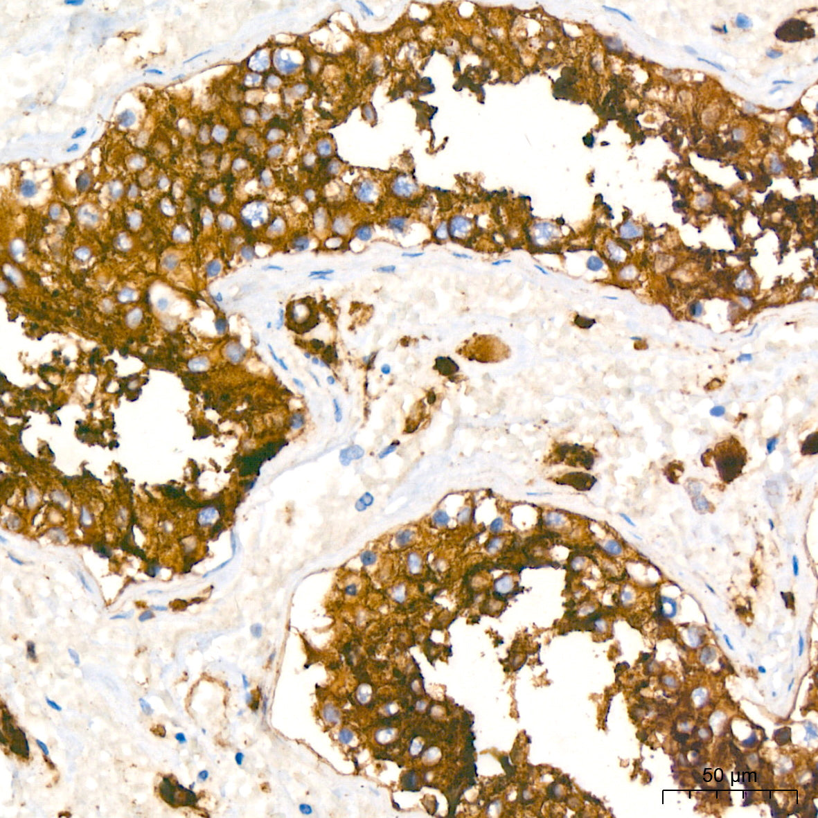 ACE2 Rabbit mAb