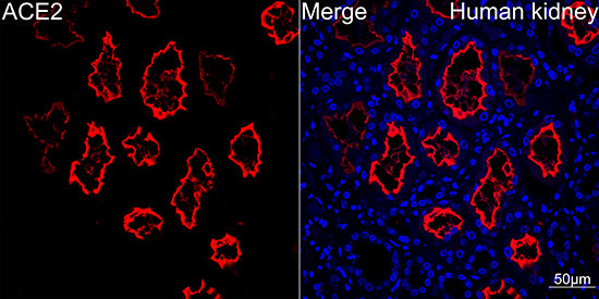 ACE2 Rabbit mAb