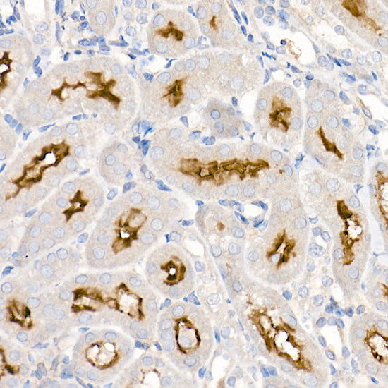 ACE2 Rabbit mAb