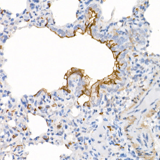ACE2 Rabbit mAb