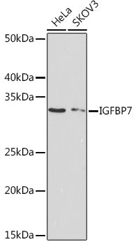 IGFBP7 Rabbit mAb