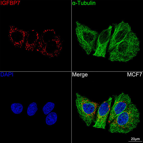 IGFBP7 Rabbit mAb