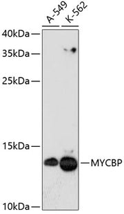 MYCBP Rabbit pAb