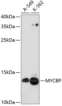 MYCBP Rabbit pAb