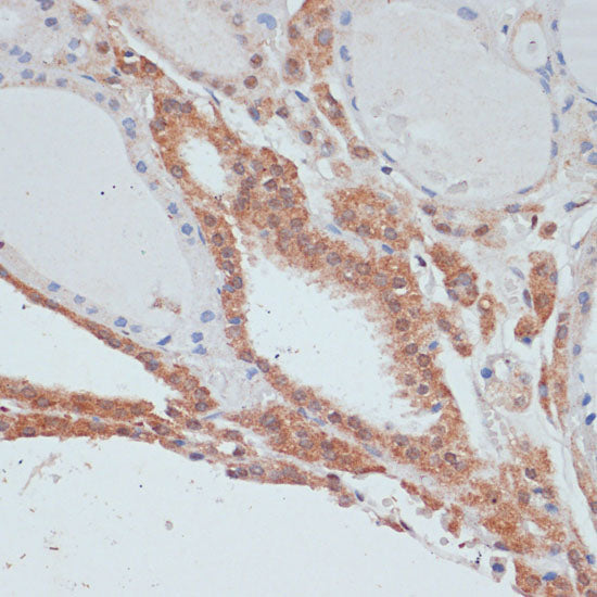 MYCBP Rabbit pAb