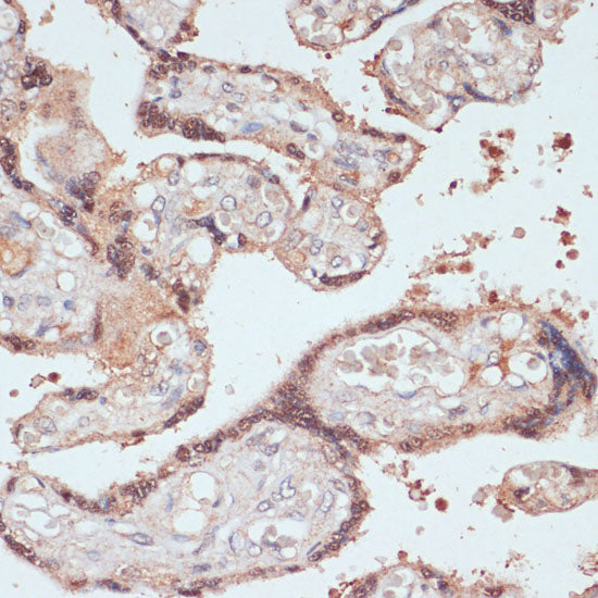 MYCBP Rabbit pAb