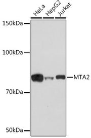 [KO Validated] MTA2 Rabbit mAb