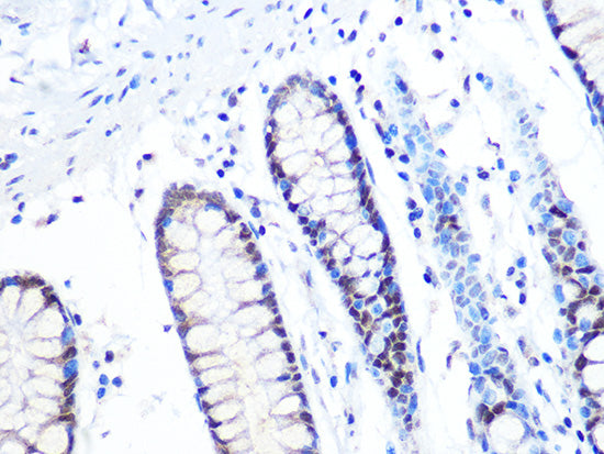 [KO Validated] MTA2 Rabbit mAb