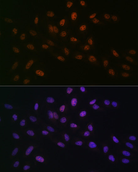 [KO Validated] MTA2 Rabbit mAb