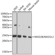MAD2B/MAD2L2 Rabbit mAb