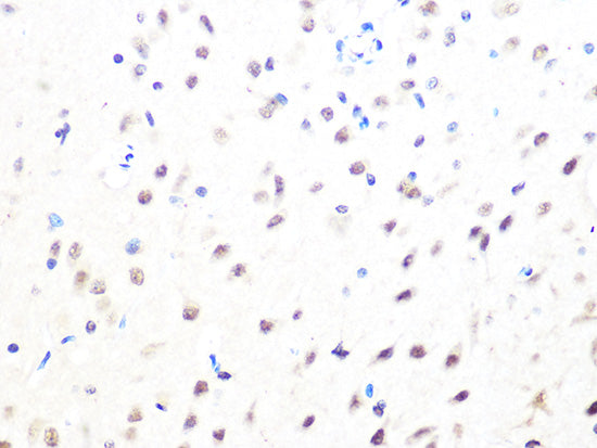MAD2B/MAD2L2 Rabbit mAb