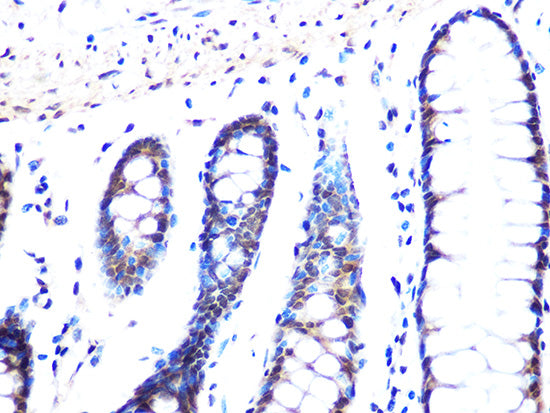 MAD2B/MAD2L2 Rabbit mAb