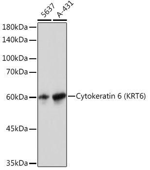 Cytokeratin 6 (KRT6) Rabbit mAb