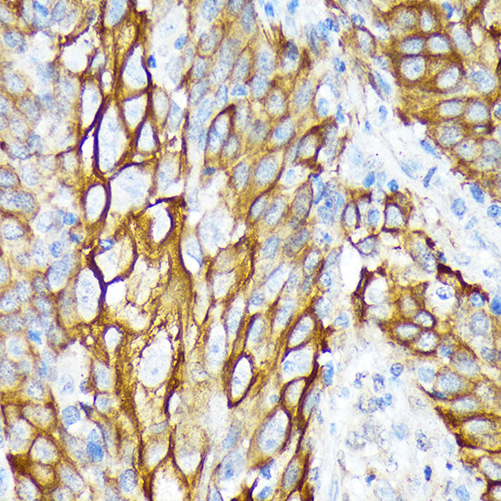 Cytokeratin 6 (KRT6) Rabbit mAb