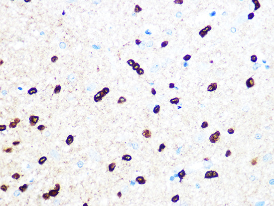 TPPP/p25 Rabbit mAb