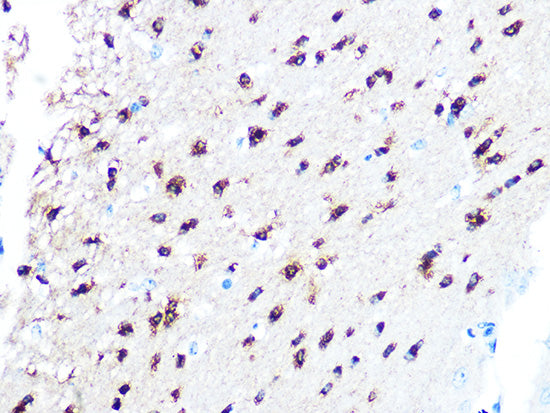 TPPP/p25 Rabbit mAb