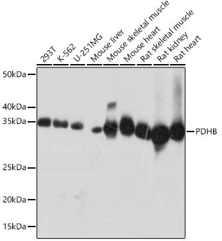 PDHB Rabbit mAb