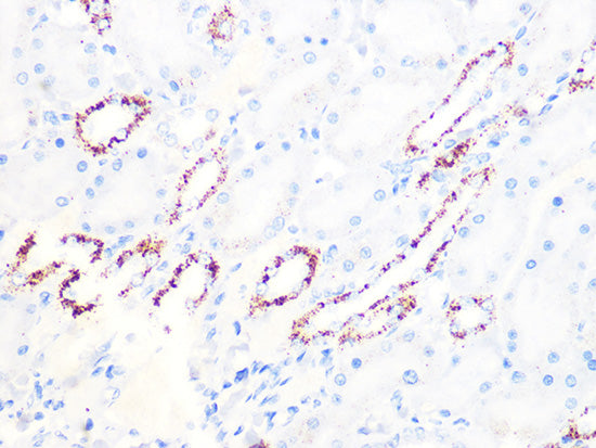 PDHB Rabbit mAb