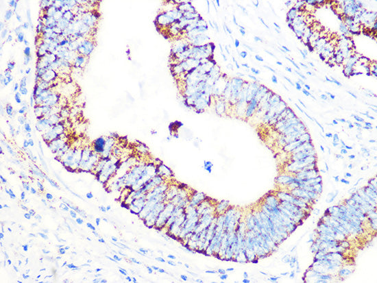 PDHB Rabbit mAb