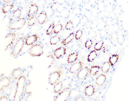 PDHB Rabbit mAb