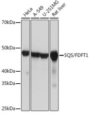 SQS/FDFT1 Rabbit mAb