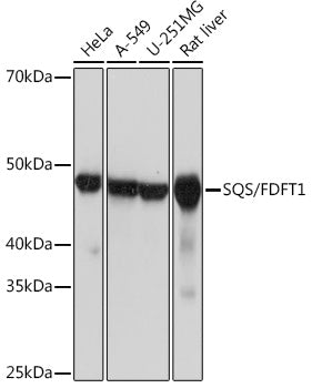 SQS/FDFT1 Rabbit mAb