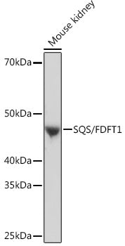 SQS/FDFT1 Rabbit mAb