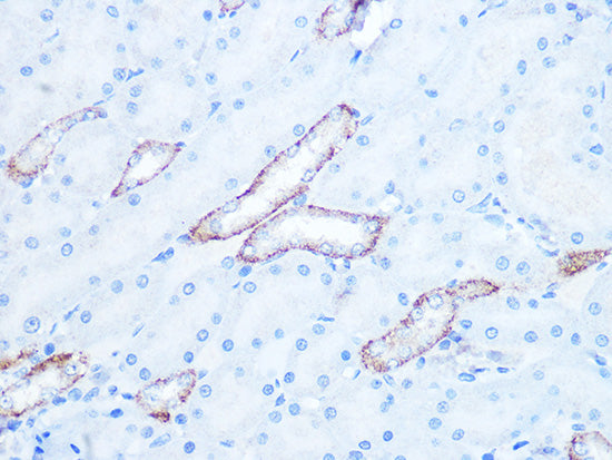 IRAK2 Rabbit mAb