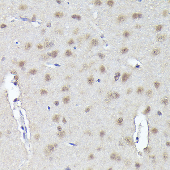 CRCP Rabbit pAb
