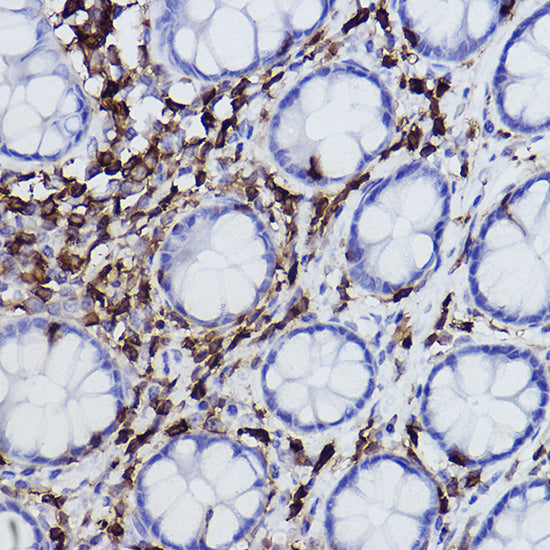 L-Plastin/LCP1 Rabbit mAb
