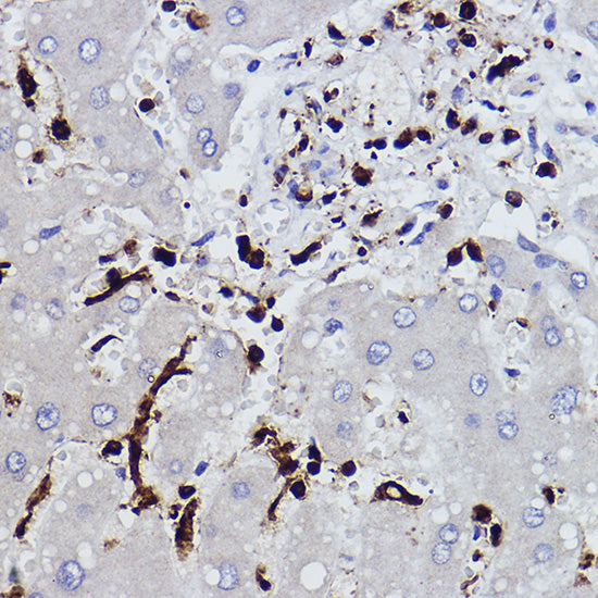 L-Plastin/LCP1 Rabbit mAb