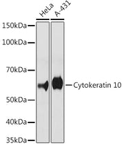 Cytokeratin 10 Rabbit mAb