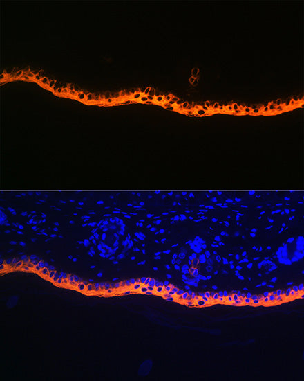 Cytokeratin 10 Rabbit mAb