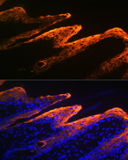 Cytokeratin 10 Rabbit mAb