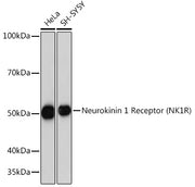 Neurokinin 1 Receptor (NK1R) Rabbit mAb