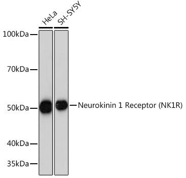 Neurokinin 1 Receptor (NK1R) Rabbit mAb