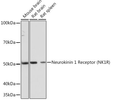 Neurokinin 1 Receptor (NK1R) Rabbit mAb
