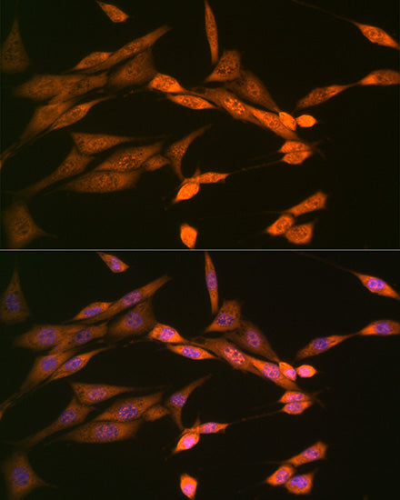 DISC1 Rabbit mAb