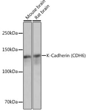 K-Cadherin (CDH6) Rabbit mAb