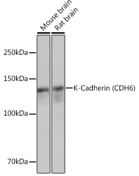 K-Cadherin (CDH6) Rabbit mAb