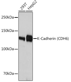 K-Cadherin (CDH6) Rabbit mAb