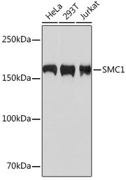 SMC1 Rabbit mAb