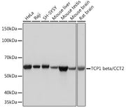 TCP1 beta/CCT2 Rabbit mAb