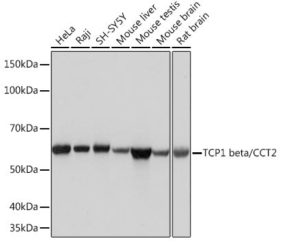 TCP1 beta/CCT2 Rabbit mAb