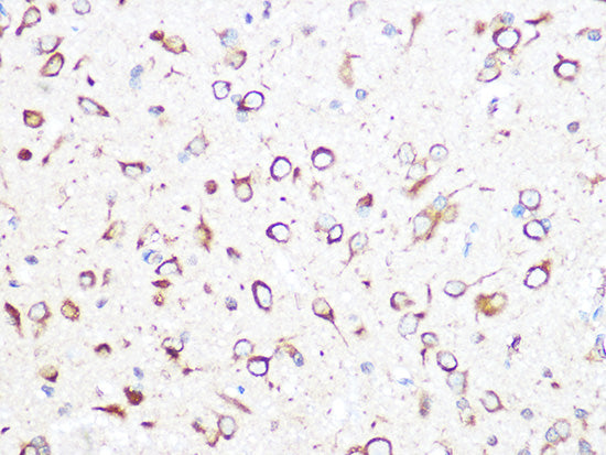 TCP1 beta/CCT2 Rabbit mAb