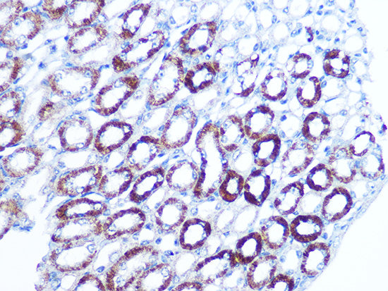 BAG3 Rabbit mAb